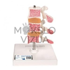 Žmogaus osteoporozės modelis