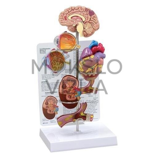 Hipertenzijos demonstracinis rinkinys