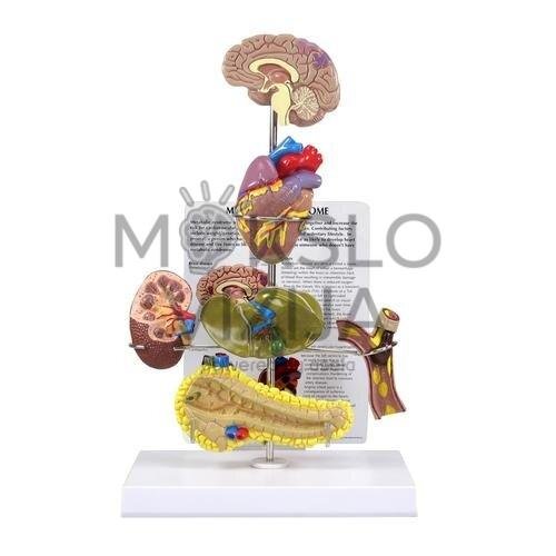 Metabolinio sindromo demonstracinis modelis