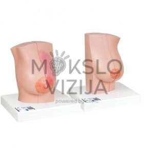 Moteriškos krūties su sveikais ir nesveikais audiniais modelis