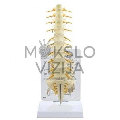 T8-T12 ir L1-L5 stuburo slankstelių modelis