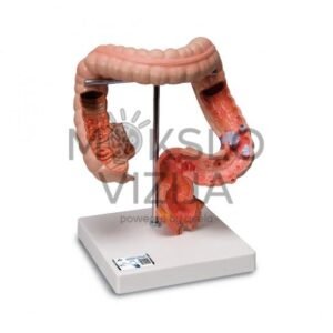 Žarnyno ligų modelis