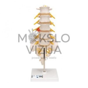 Žmogaus juosmens stuburinės dalies modelis su šoninio prolapso tarpslanteliniu disku