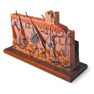 Žmogaus odos modelis su nudegimais, 75 kartus padidintas