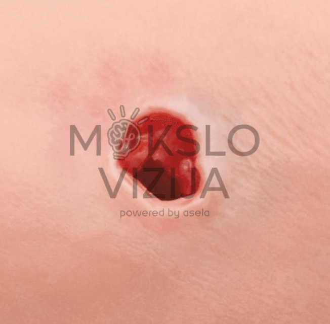 Rankos kraujavimo simuliatorius - Image 4