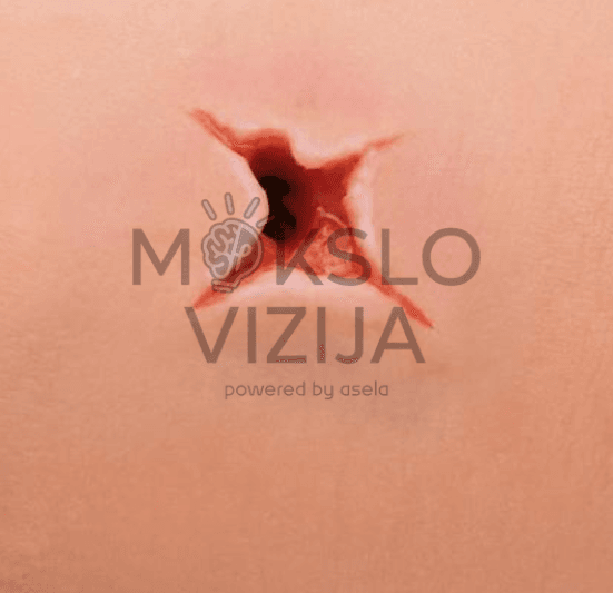 Rankos kraujavimo simuliatorius - Image 7