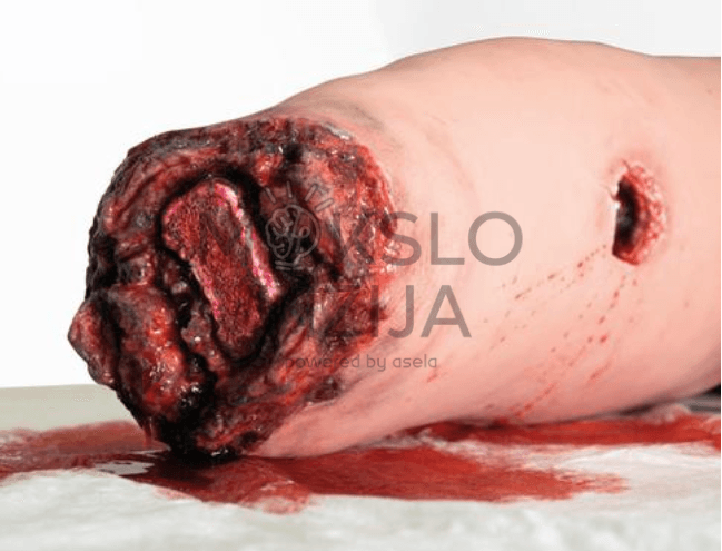 Kojos kraujavimo simuliatorius - Image 2