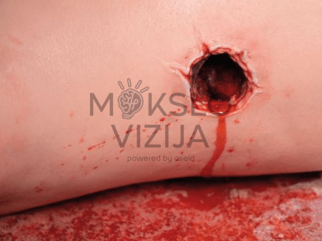 Kojos kraujavimo simuliatorius - Image 4