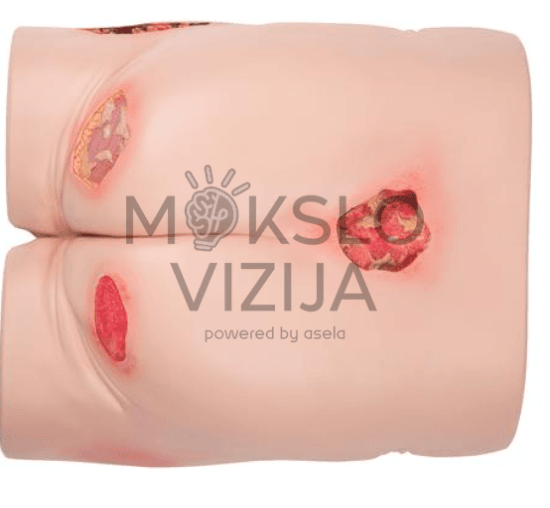 Dekubito treniruoklis slaugos mokymams