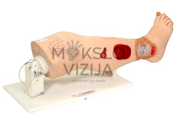 medicinos mokymo kojos modelis su venų ligų sukeltais odos pažeidimais
