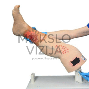 veninio nepakankamumo kojos modelis su įvairiais odos pažeidimais medicinos mokymui
