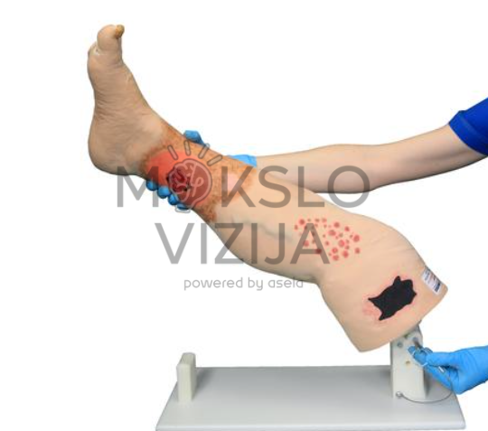 veninio nepakankamumo kojos modelis su įvairiais odos pažeidimais medicinos mokymui