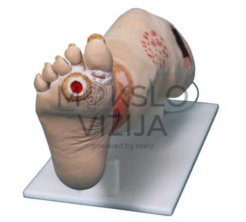 medicinos mokymo modelio pėdos opa veninio nepakankamumo ir žaizdų priežiūros mokymui