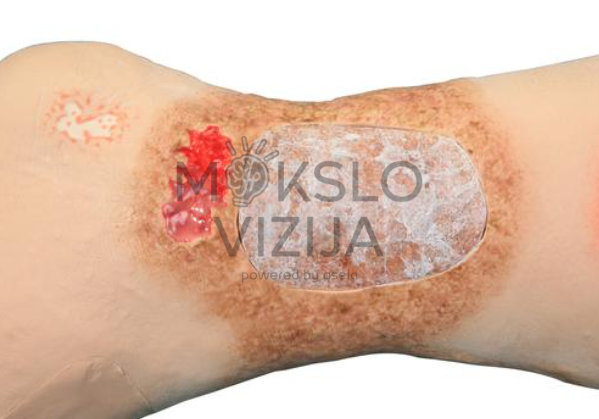veninės opos ir odos pažeidimų imitacija medicininio mokymo kojos modelyje
