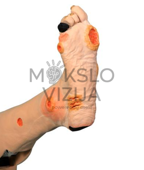 arterinės opos ir audinių pažeidimai pėdos mokymo modelyje medicinos mokymui