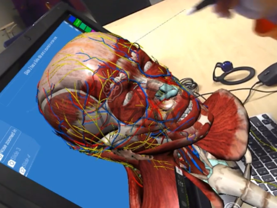 3D žmogaus galvos anatomijos modelis su nervų ir kraujagyslių sistema rodomas interaktyviame ekrane